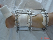 3-surgery