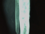 10-after
