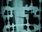 7-surgery